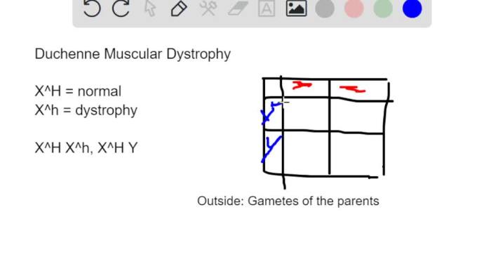 Muscular dystrophy duchenne inheritance disease syndrome recessive pattern fabry linked genetics granulomatous chronic genetic autosomal family horn chart testing symptoms